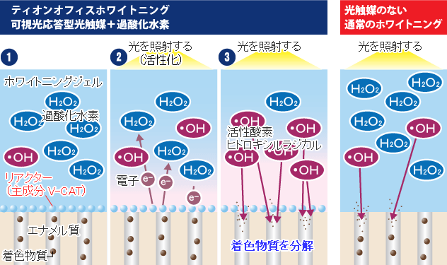 ティオンオフィスホワイトニングの治療について