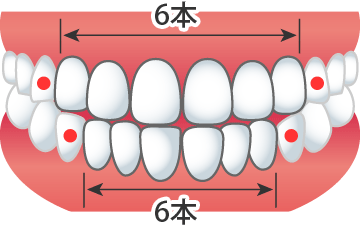 Vividオフィスホワイトニングで何本の歯を白くできるの？