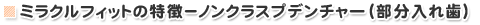 ミラクルフィットの特徴−ノンクラスプデンチャー（部分入れ歯）