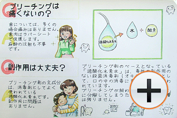 ホワイトニングのよくある質問