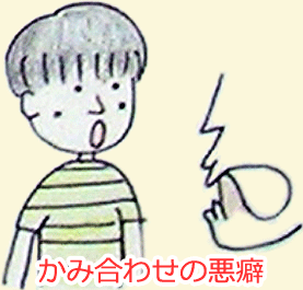 かみ合わせの悪癖