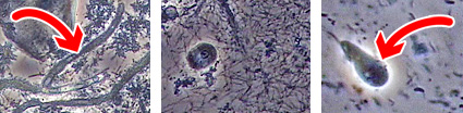 歯周病の原因となる多様な微生物