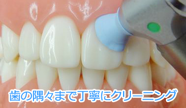 虫歯・歯周病予防に有効なＰＭＴＣ