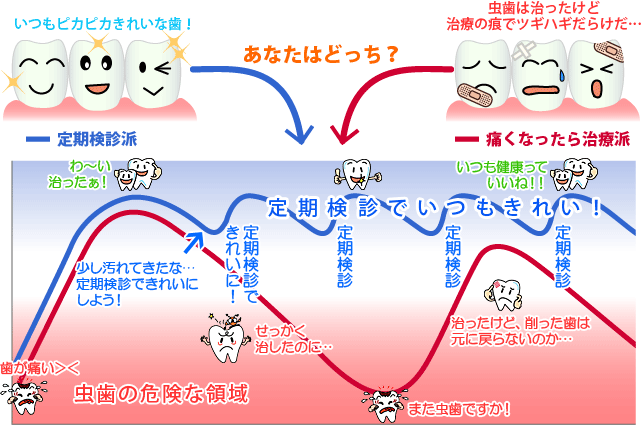 あなたは“健康に良い歯科定期検診派” それとも“痛くなったら歯医者さんに行く派”